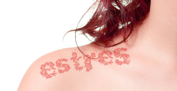 ¿Estresado? ¡Cuidado con la Psoriasis! 1 ¿Estresado? ¡Cuidado con la Psoriasis!