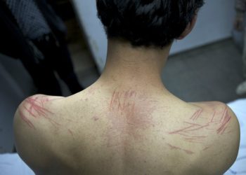 ¡IMPACTANTE! Conoce los métodos de tortura israelí contra niños y niñas palestinos 2 ¡IMPACTANTE! Conoce los métodos de tortura israelí contra niños y niñas palestinos