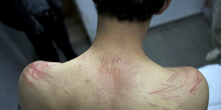¡IMPACTANTE! Conoce los métodos de tortura israelí contra niños y niñas palestinos 1 ¡IMPACTANTE! Conoce los métodos de tortura israelí contra niños y niñas palestinos
