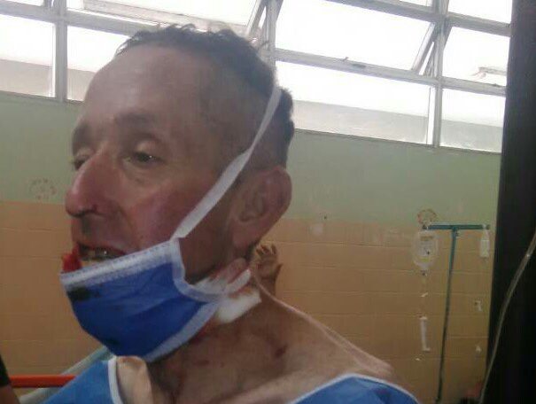 ¡ASESINOS! Casi degollado por una Guaya camino a su casa en Mérida (+Fotos) 2 C_Dars4W0AAtzif