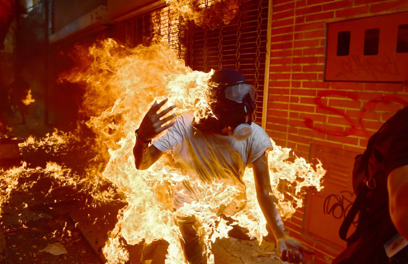 ¡TERROR! Joven es quemado por su compañero durante manifestación en Altamira (+Video y fotos) 2 Opositor-quemado