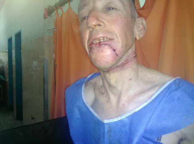 ¡ASESINOS! Casi degollado por una Guaya camino a su casa en Mérida (+Fotos) 4 kll